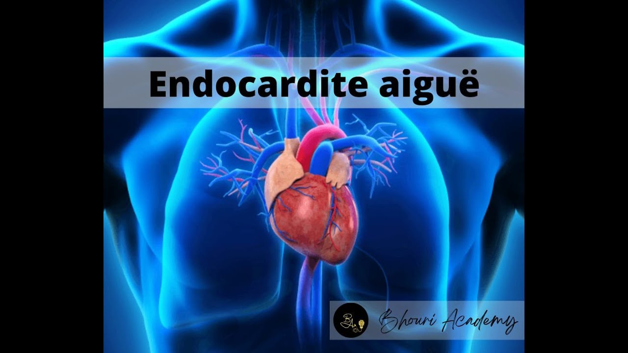 Préparation EVC de la PAE _ épisode11: Extrait du cours Endocardite ...