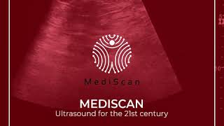 MediScan: Ultrasound for the 21st Century