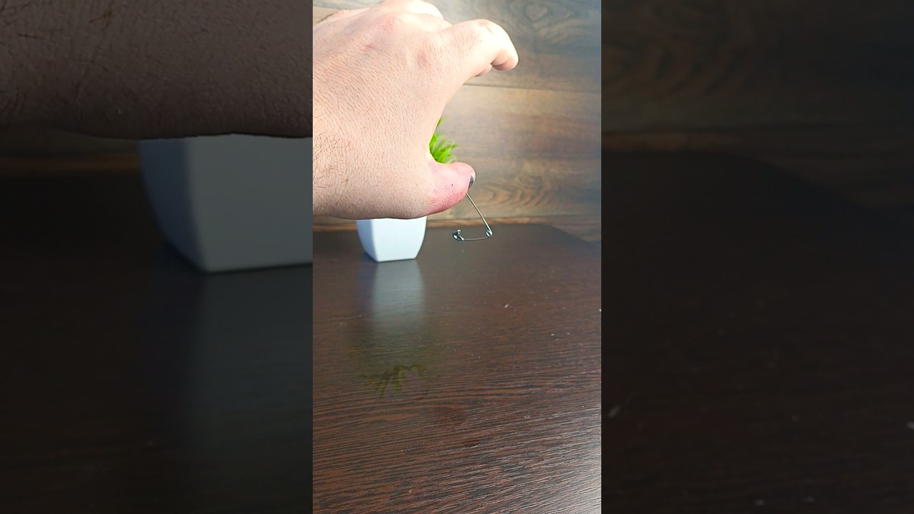 Ноготь почернел от удара. Что делать?