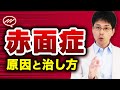 【赤面症】顔が赤くなる原因と治し方