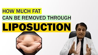 How Much Fat Can be Removed Through Liposuction? कितना फैट घटेगा | Dr. PK Talwar