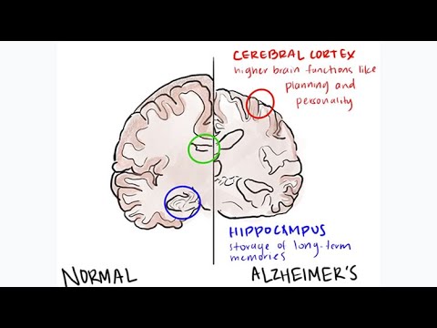 Toxicity of Protein Involved with Alzheimer’s Triggered by Chemical “Switch