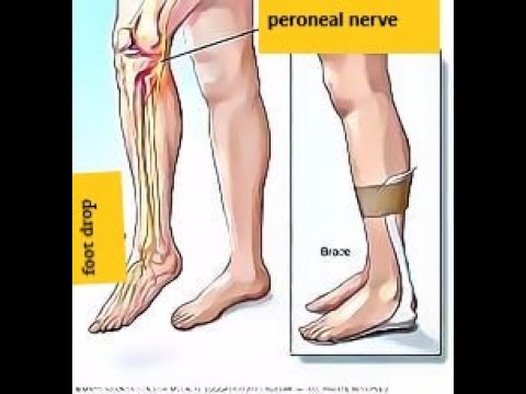 Anatomy Of The Lower Leg - Everything You Need To Know - Dr. Nabil