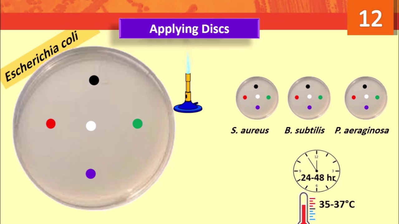 Test Effectiveness of Disinfectants by Disc Diffusion Method- Lab 12 -  YouTube