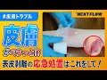 【表皮剥離】訪問看護師が教える緊急時対応方法!実践!