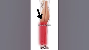 Gastrocnemius Trigger Points