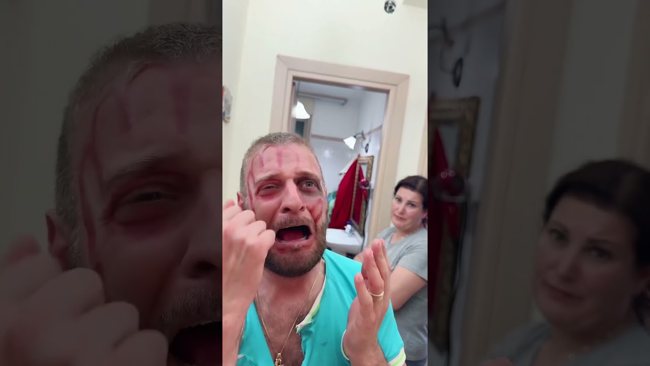 Il coraggio di Ciccio 😩😂