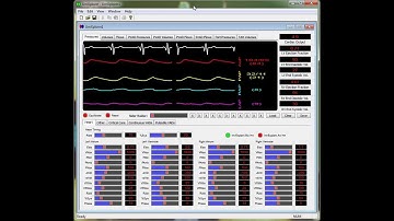 Hemodynamics simulation using UmXplorer