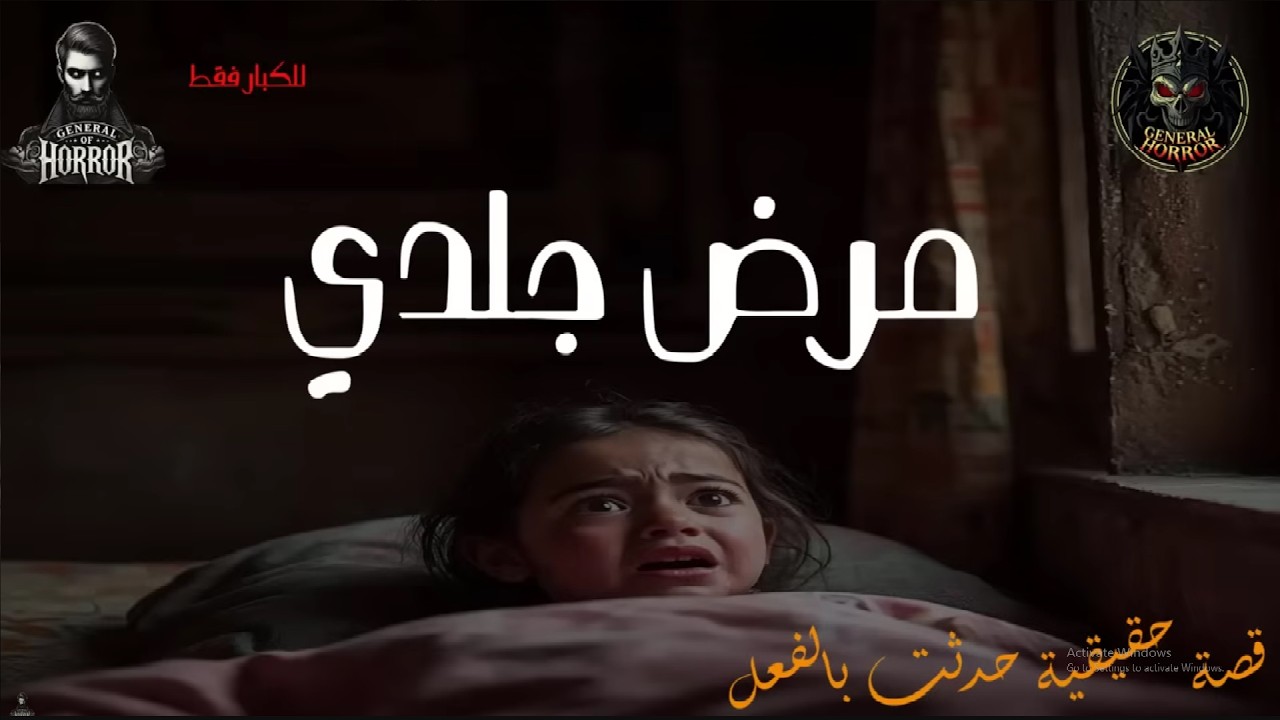 قصة حقيقية حدثت بالفعل عن أم تلجأ للسحر والأعمال بسبب مرض جلدي نادر ظهر على ابنتها والنتيجة كانت !!