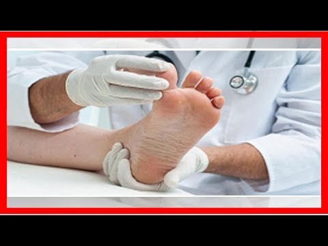 6 أسباب خطيرة وراء ظهور البقع السوداء في أظافر القدم