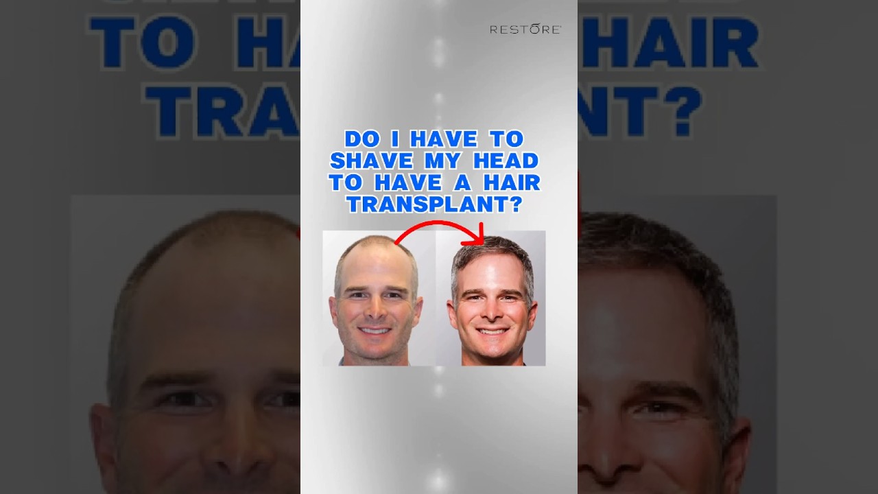 Dr. Harris Explains the Benefits of No-Shave FUE Hair Transplants ✨💇‍♂️ | Restore Hair