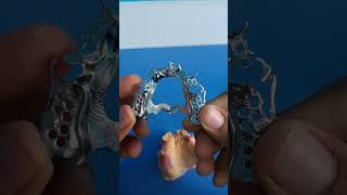 PPR extructura #protesisdental #odontologia #laboratoriodental #dentadura screenshot 3