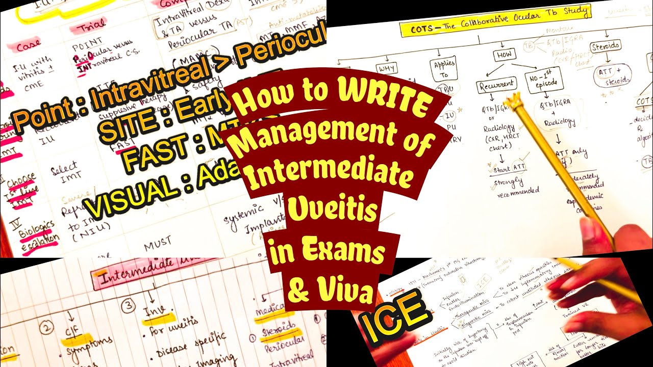 Intermediate Uveitis Treatment Major Trials | How to WRITE in Exams & VIVA Pearls | MS/DNB Ophthal