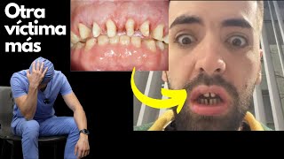 🚩Una víctima más del turismo dental en Turquía | "Diseño de sonrisa" express