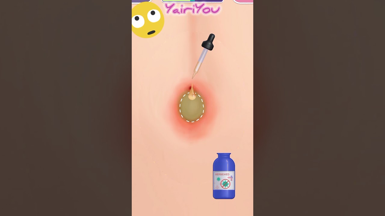 💎LIMPIEZA DE PIERCING🧴🪩 Skincare Time 