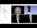 Creating Lifelike Muscle and Skin 3D Printable STL Files from Medical CT Scans Using a Free Service