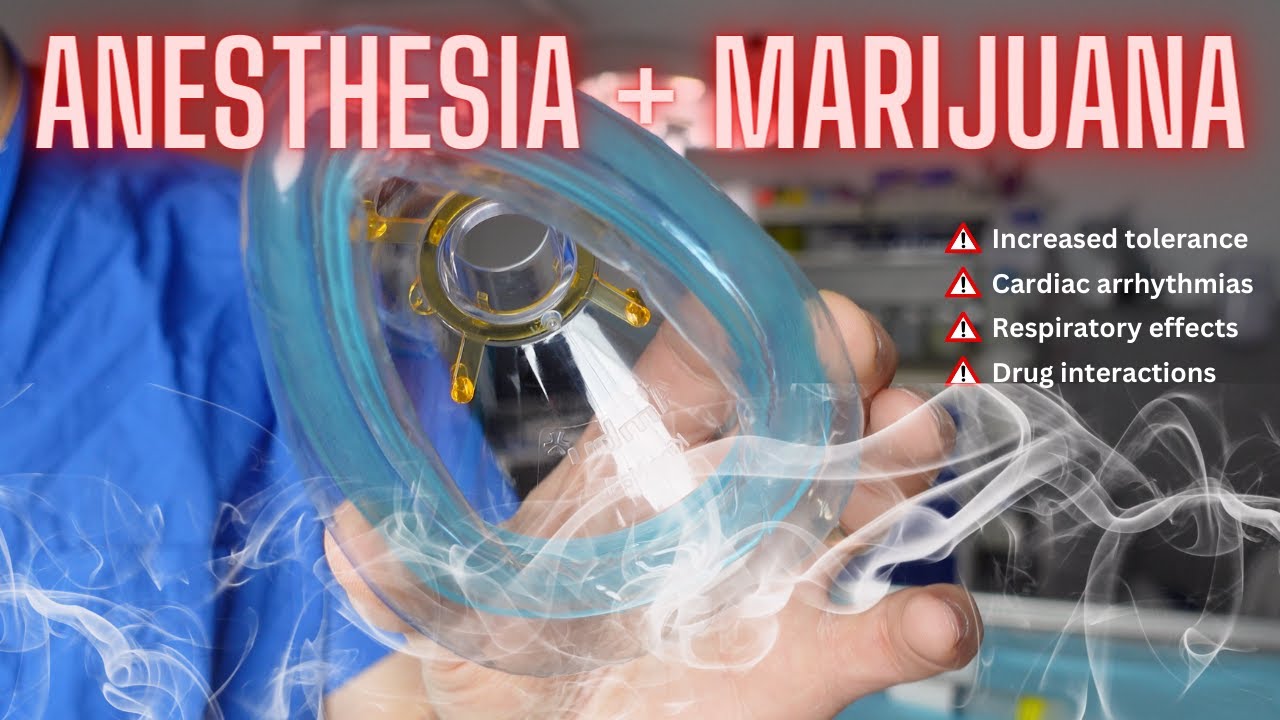 Patients shouldn't lie about marijuana to their anesthesiologist