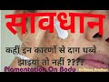 Pigmentationon face  pigmentationtreatment  pigmentationin hindi  dr veena pradhan