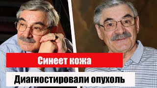 Синеет кожа: у госпитализированного Панкратова-Черного диагностировали опухоль.