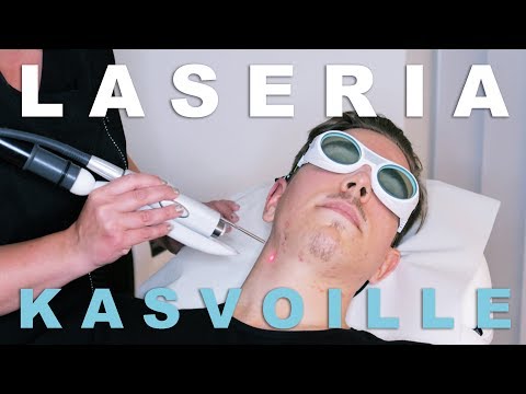 Video: Arvien Laserhoito: Kustannukset, Tehokkuus, Kasvot Ja Muut