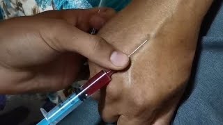 طريقه اعطاء حقن وريد لكبار السن_How to give an intravenous injection to an elderly person
