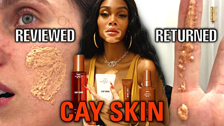 How Winnie Harlow DESTROYED My Face.  (The Cay Ski...