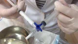 Escleroterapia com espuma