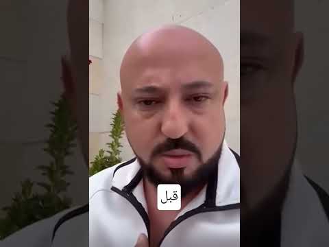 الشبيح وسيم الاسد قبل وبعد بدون حقوق