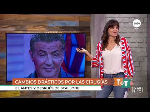 Columna Rosa: celebridades enamoradas de las cirugías estéticas