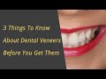 Top 3 things to know about Dental Veneers - Before you have them!