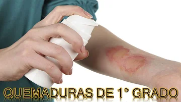 ¿Cómo son las quemaduras de primer grado?