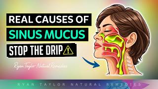 The Real Cause of Sinus Mucus (Stop The Drip)