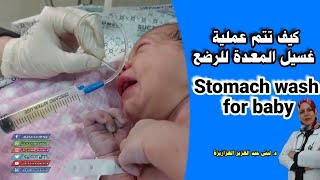 كيف تتم عملية غسيل المعدة للرضع Stomach wash for baby 2021