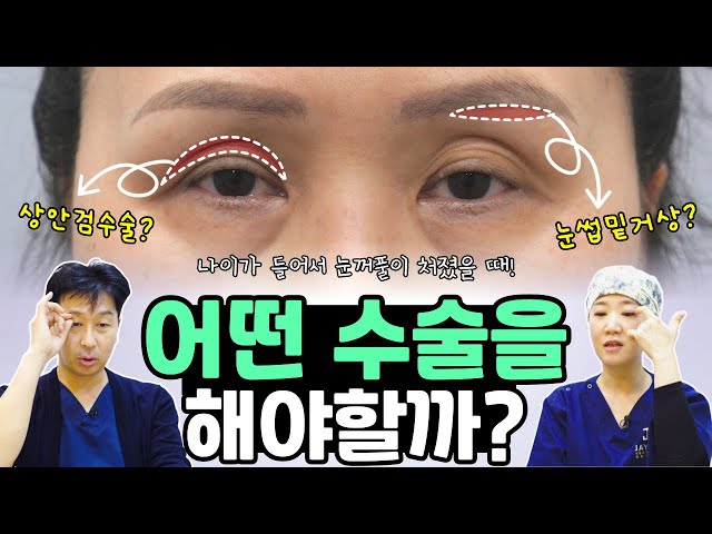 눈꺼풀이 처졌을 때 상안검 vs 눈썹하거상 | 요즘 트랜드는?
