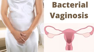 Bacterial Vaginosis | Bacterial Infection of Vagina #kkbiology #bacteria #infection