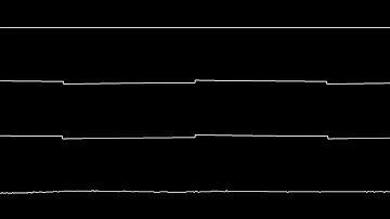 [Atari XE] Fred Brooker - Vaxeen 4U (Oscillioscope)