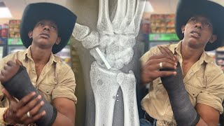 CASSIO DIAS Revela Detalhes da FRATURA na Mão 🖐️ Ele Teve Que Fazer Cirurgia