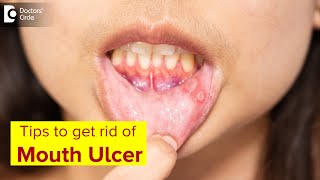 Mouth Ulcer| Mouth Sores: Symptoms, Treatment & Prevention Methods-Dr.Lahari A.S.R | Doctors' Circle screenshot 5