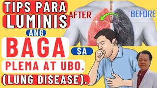 Tips Para Luminis ang Baga sa Plema at Ubo (Lung Disease).  By Doc Willie Ong