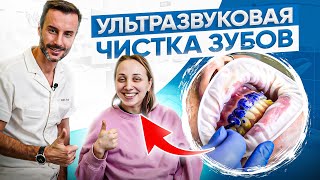 Ультразвуковая чистка зубов у стоматолога - Макросъемка