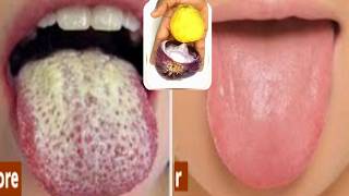 Remove smelling mouth properly cleanse your tongue, whiter teeth