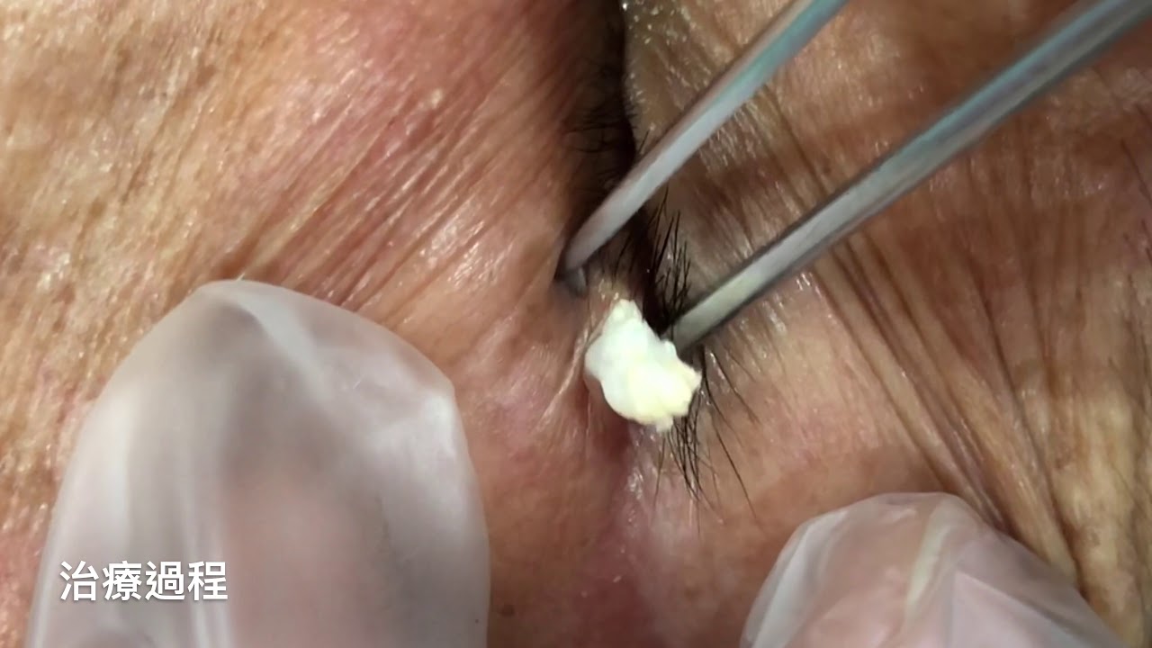 Age Restrict Video