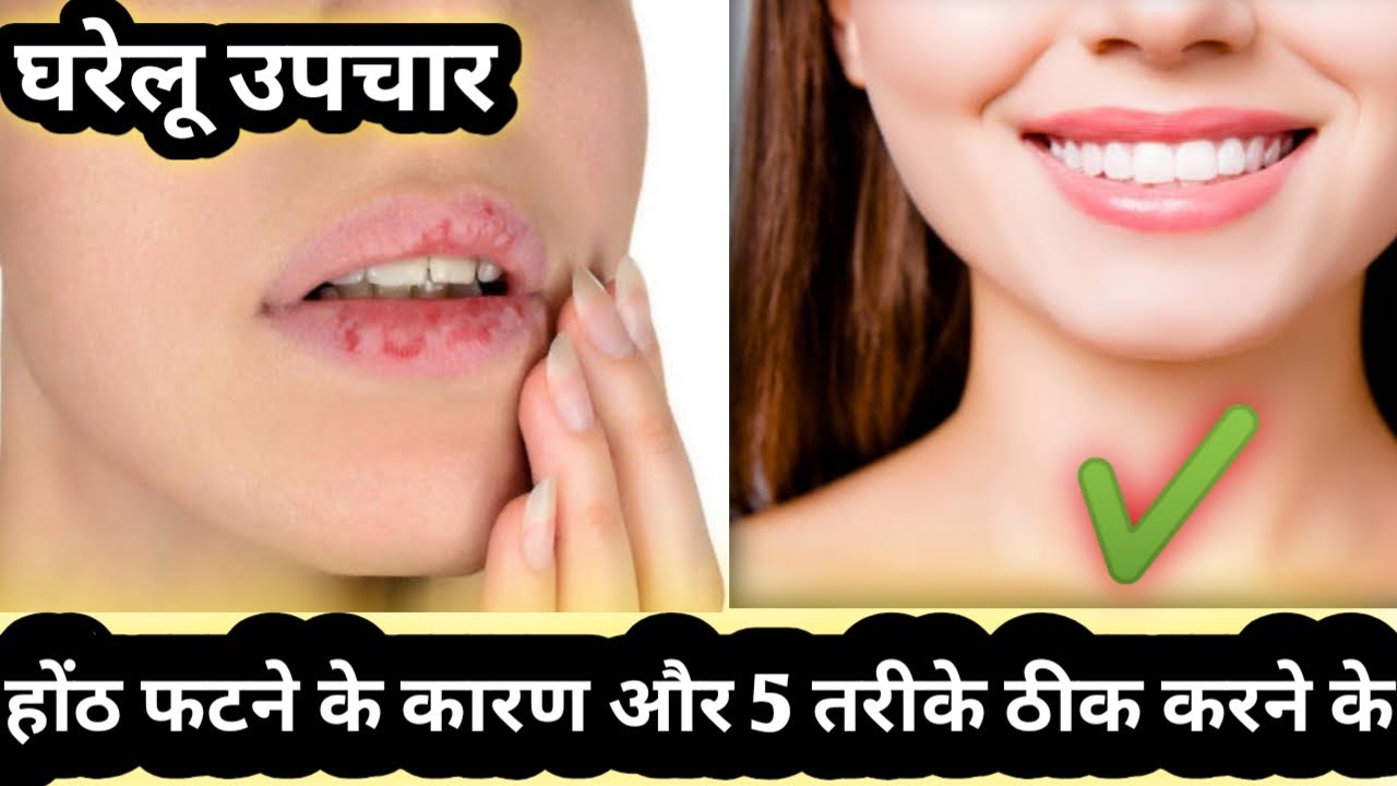 Lips ko fatne se kaise roke/fate hatho ke liye upay/Chandigarh Beauty