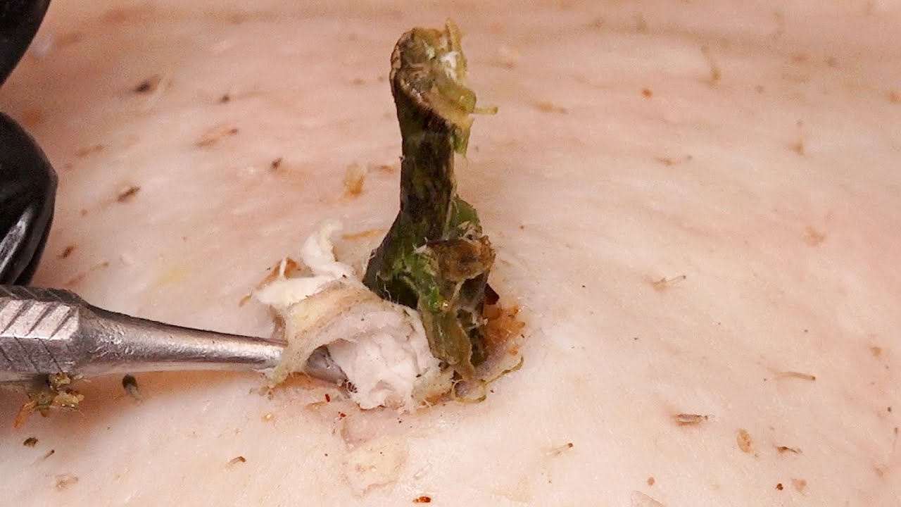 Amazing Toenails, Too Thick, Trim Them Slowly | Professional pedicure process【Xue Yidao】0401003