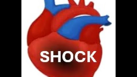 Cardiogenic Shock Mx_Dr Pradeep Rangappa