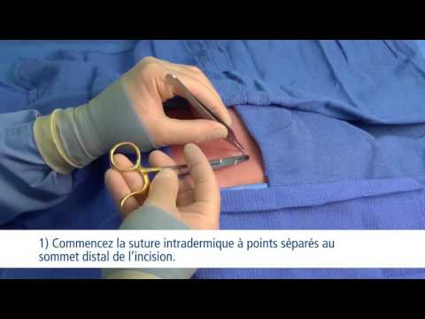 Vidéo de formation sur les techniques de points de sutures