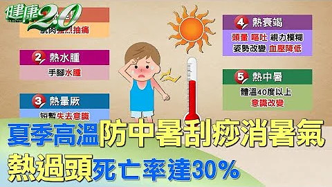 夏季高温防中暑刮痧消暑气 热过头死亡率达30％ 健康2.0 - 天天要闻