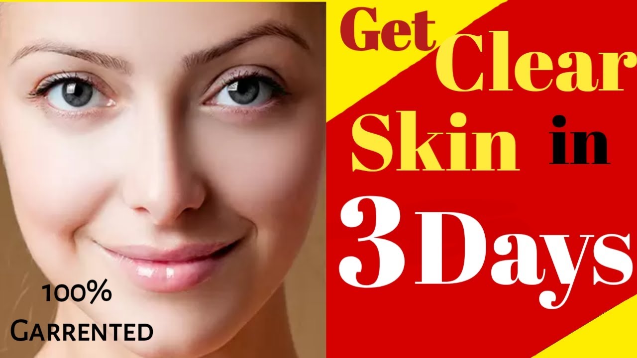 Get Clear Skin in 3 Days | Permanent Skin whitening Home Remedy ...