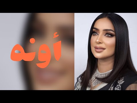 فاطمة زهرة العين أونه     