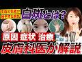 【皮膚科医完全解説】白斑(はくはん)とは?皮膚の色素が脱色する原因・種類・治療法を皮膚科医がわかりやすく解説【尋常性白斑、老人性白斑、自己免疫、エキシマ】